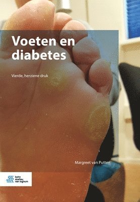 Margreet Van Putten, Margreet van Putten - Voeten En Diabetes, Häftad