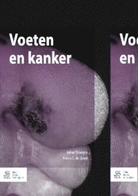 bokomslag Voeten En Kanker