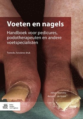 Voeten en nagels 1