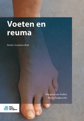 bokomslag Voeten En Reuma