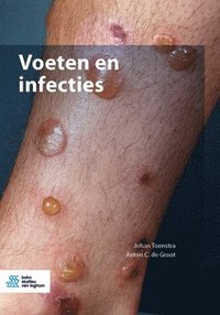 bokomslag Voeten En Infecties