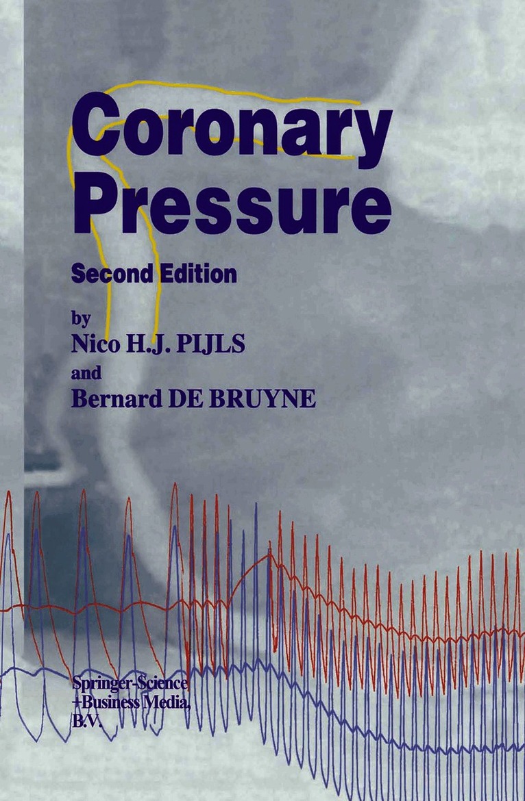 Coronary Pressure