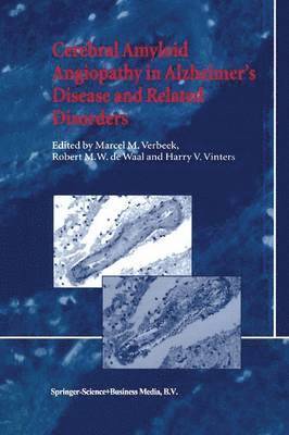 Cerebral Amyloid Angiopathy in Alzheimers Disease and Related Disorders 1