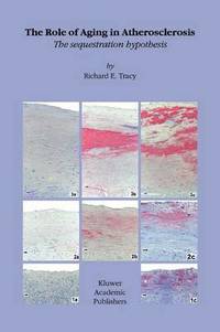 bokomslag Role of Aging in Atherosclerosis