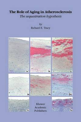 bokomslag Role of Aging in Atherosclerosis