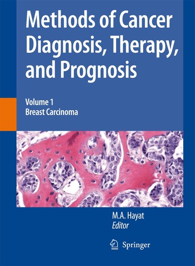 M. A. Hayat - Methods of Cancer Diagnosis, Therapy and Prognosis, Häftad