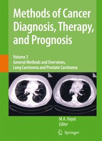bokomslag Methods of Cancer Diagnosis, Therapy and Prognosis