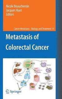 bokomslag Metastasis of Colorectal Cancer