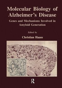 bokomslag Molecular Biology of Alzheimer's Disease