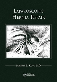 bokomslag Laparoscopic Hernia Repair