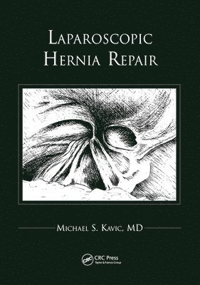 Laparoscopic Hernia Repair 1