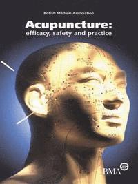 Acupuncture 1