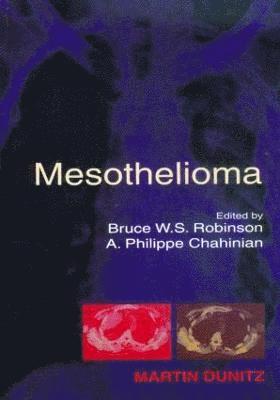 bokomslag Mesothelioma