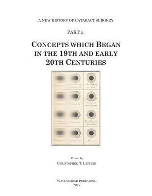 bokomslag History of Cataract Surgery