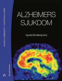 bokomslag Alzheimers sjukdom