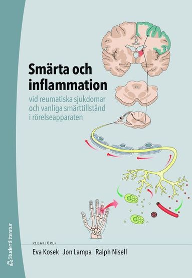 bokomslag Smärta och inflammation - vid reumatiska sjukdomar och vanliga smärttillstånd i rörelseapparaten