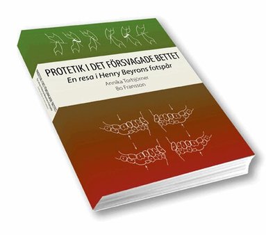 Annika Torbjörner, Bo Fransson - Protetik i det försvagade bettet : en resa i Henry Beyrons fotspår, Häftad