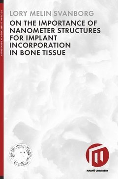 On the importance of nanometer structures for implant incorporation in bone tissue 1