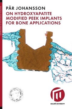 On hydroxyapatite modified peek implants for bone applications 1