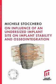 Michele Stocchero - On influence of undersized implant site on implant stability and osseointegration, Häftad