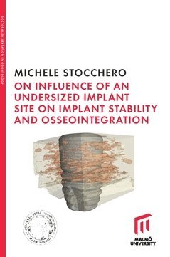 bokomslag On influence of undersized implant site on implant stability and osseointegration