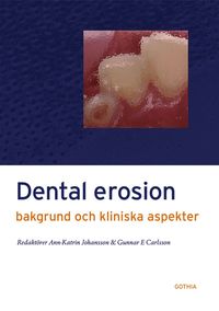 bokomslag Dental erosion : bakgrund och kliniska aspekter