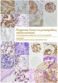 bokomslag Prognostic factors in periampullary adenocarcinoma