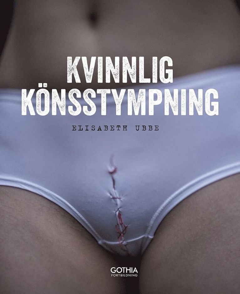 Kvinnlig könsstympning