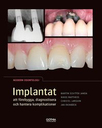 bokomslag Implantat : att förebygga, diagnostisera och hantera komplikationer