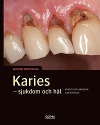 bokomslag Karies : sjukdom och hål