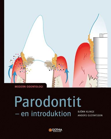 bokomslag Parodontit : en introduktion