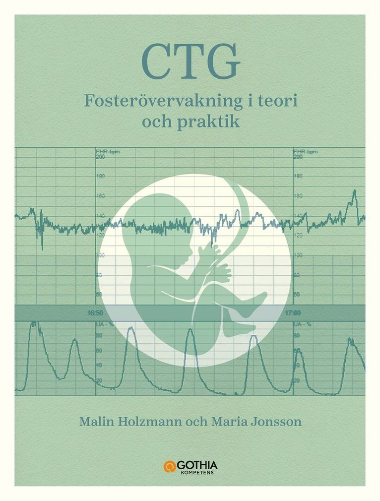 Malin Holzmann, Maria Jonsson - CTG : fosterövervakning i teori och praktik, Häftad