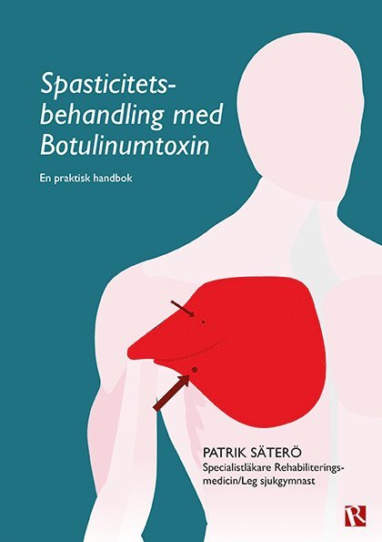 Spasticitetsbehandling med Botulinumtoxin : en praktisk handbok 1