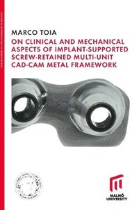bokomslag On Clinical and Mechanical Aspects of Implant-Supported Screw-Retained Multi-Unit CAD-CAM Metal Framework