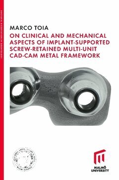 Marco Toia - On Clinical and Mechanical Aspects of Implant-Supported Screw-Retained Multi-Unit CAD-CAM Metal Framework, Häftad