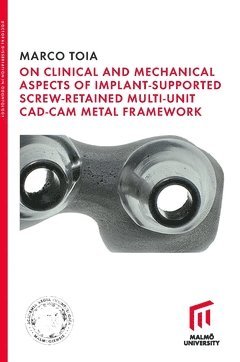 On Clinical and Mechanical Aspects of Implant-Supported Screw-Retained Multi-Unit CAD-CAM Metal Framework 1