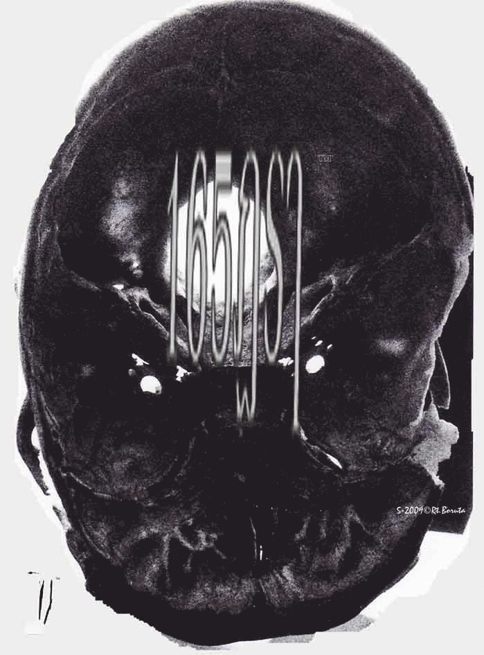165dsl, Häftad