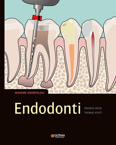 Fredrik Frisk, Thomas Kvist - Endodonti, Häftad