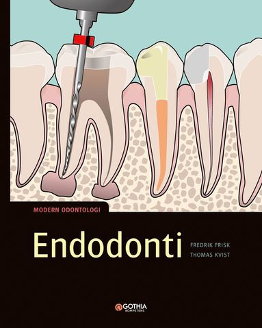 bokomslag Endodonti