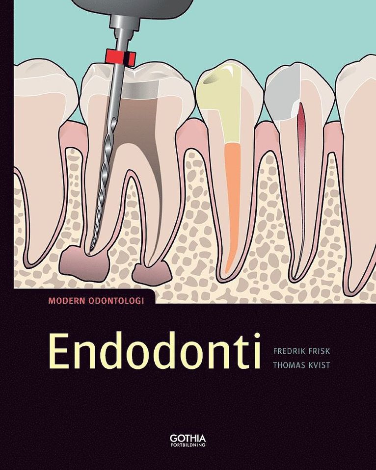 Endodonti 1