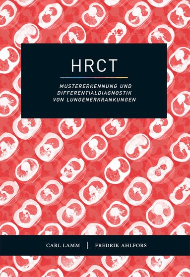 bokomslag HRCT - Mustererkennung und Differentialdiagnostik von Lungenerkrankungen