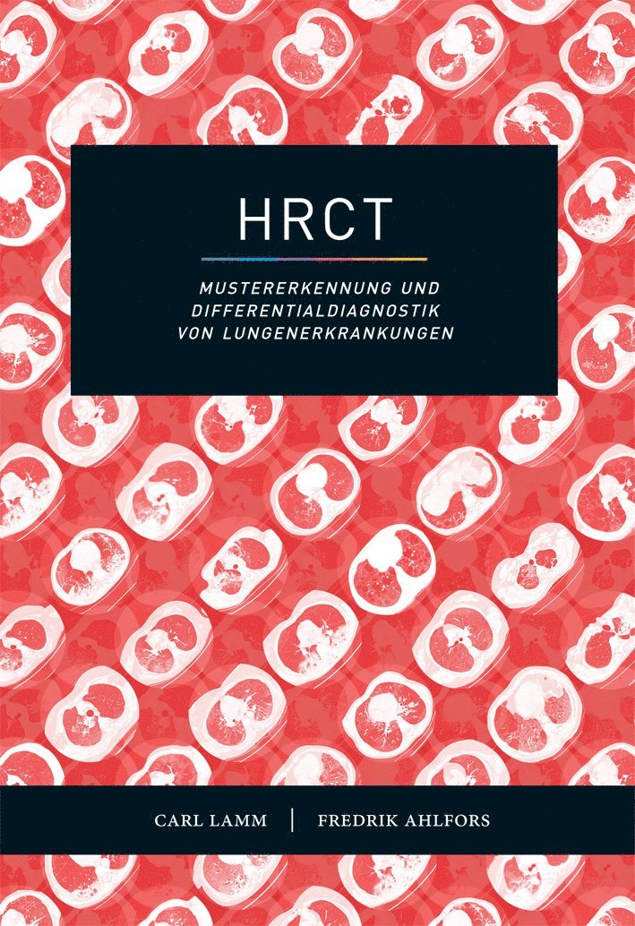 HRCT : mustererkennung und Differentialdiagnostik von Lungenerkrankungen
