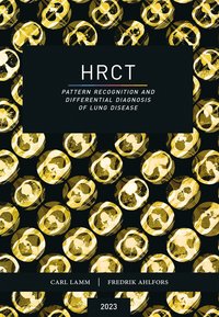 bokomslag HRCT : pattern recognition and differential diagnosis of lung disease