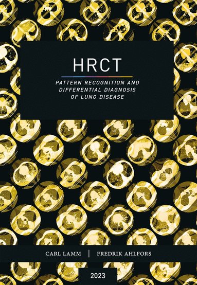 bokomslag HRCT : pattern recognition and differential diagnosis of lung disease