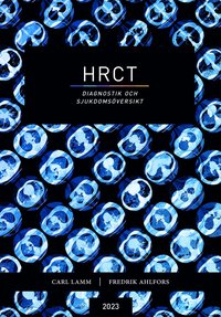 bokomslag HRCT : diagnostik och sjukdomsöversikt