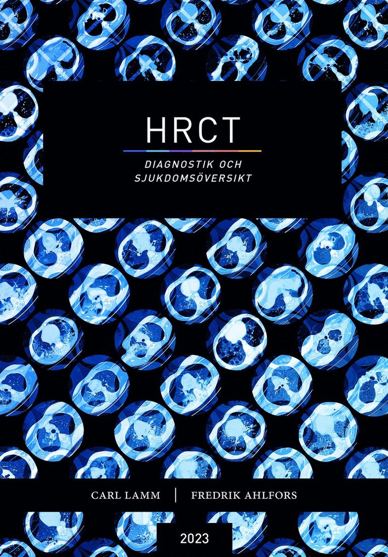 HRCT : diagnostik och sjukdomsöversikt 1