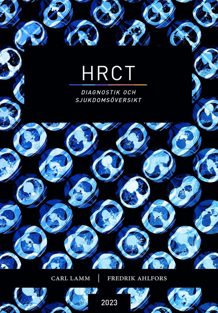 HRCT : diagnostik och sjukdomsöversikt