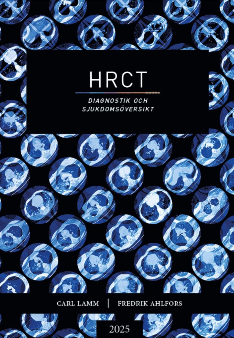 HRCT - diagnostik och sjukdomsöversikt 1