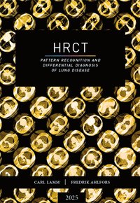 bokomslag HRCT : pattern recognition and differential diagnosis of lung disease