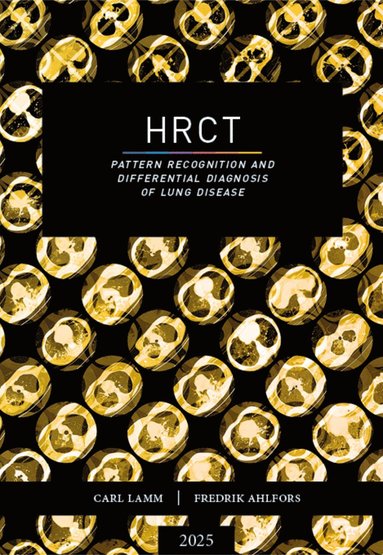 bokomslag HRCT : pattern recognition and differential diagnosis of lung disease